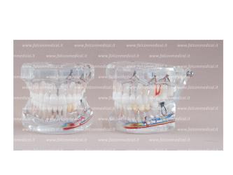 Real Series - modello endodontico, ramificato,  trasparente, dim. normal