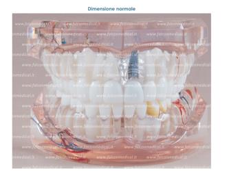 Real Series Dental model ideal occlusion transparent ramified, life size