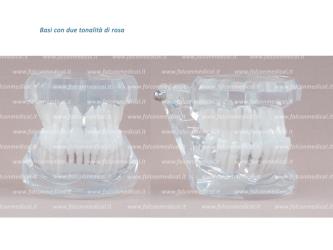 Real Series - Modello ortodontico, base rosa, Classe III