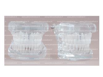 Real Series - Modello ortodontico, trasparente, Classe I, occlusione ide