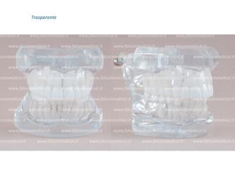 Real Series - Modello ortodontico, trasparente, Classe II, Divisione I