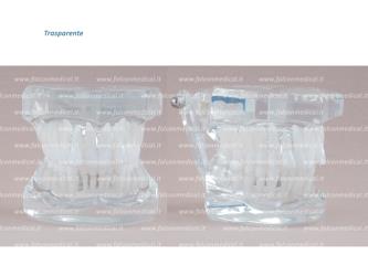 Real Series - Modello ortodontico, trasparente, Classe II, Divisione II