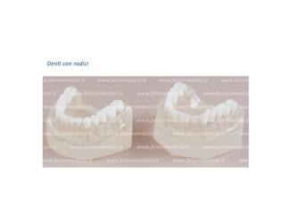 Real Series - Modello ortodontico, base rigida, Classe I - denti amovibi